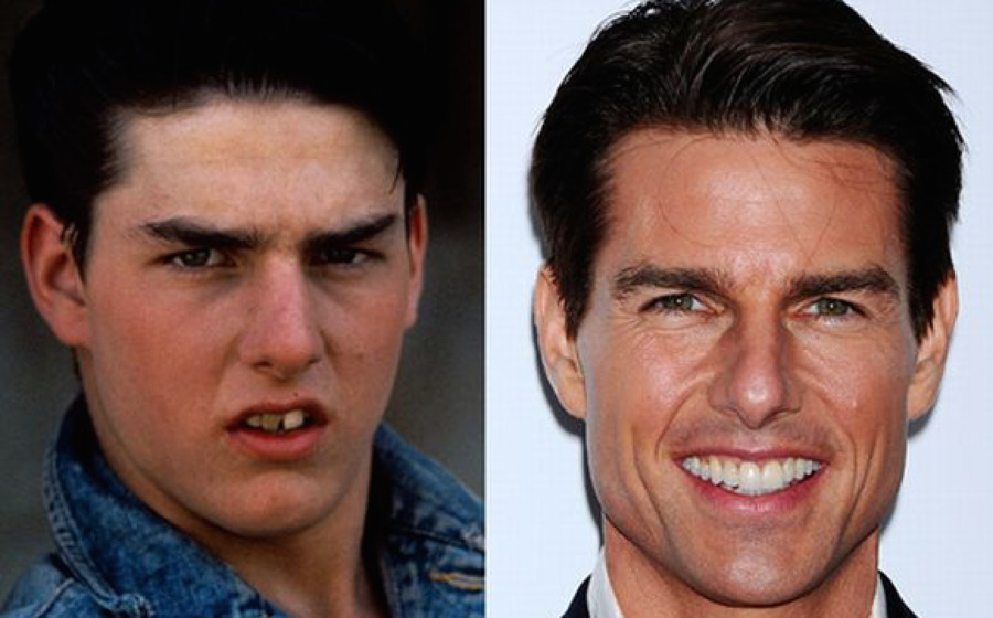 Tom Cruise antes da fama